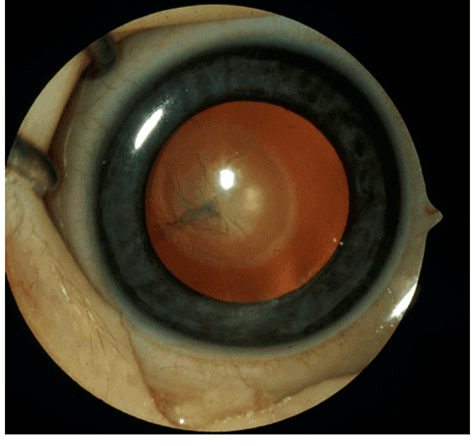Ophthalmic Surgeons